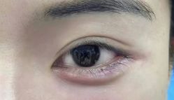 -比华利美容医院