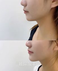 -上海漾颜医疗美容