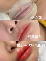 点击看大图 -杨益美学·野生眉半永久纹眉发际线