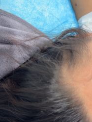 -熙朵美学植发·连锁品牌