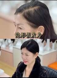 -唐风采假发补发定制