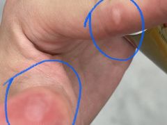 -冯鱼头火锅(青蓝山美食一条街店)