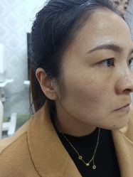 -长沙雅美医疗美容医院