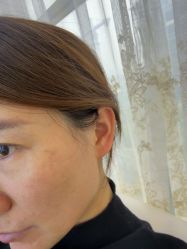 -长沙雅美医疗美容医院