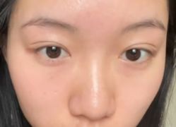 -天津健丽·去眼袋医疗美容机构