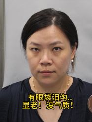-广州健丽·去眼袋医疗美容机构