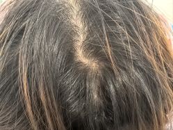 -熙朵美学植发·连锁品牌