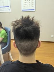 -大麦微针植发全国连锁