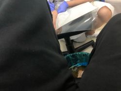 -德哥灰指甲脚气甲沟炎跖疣护理