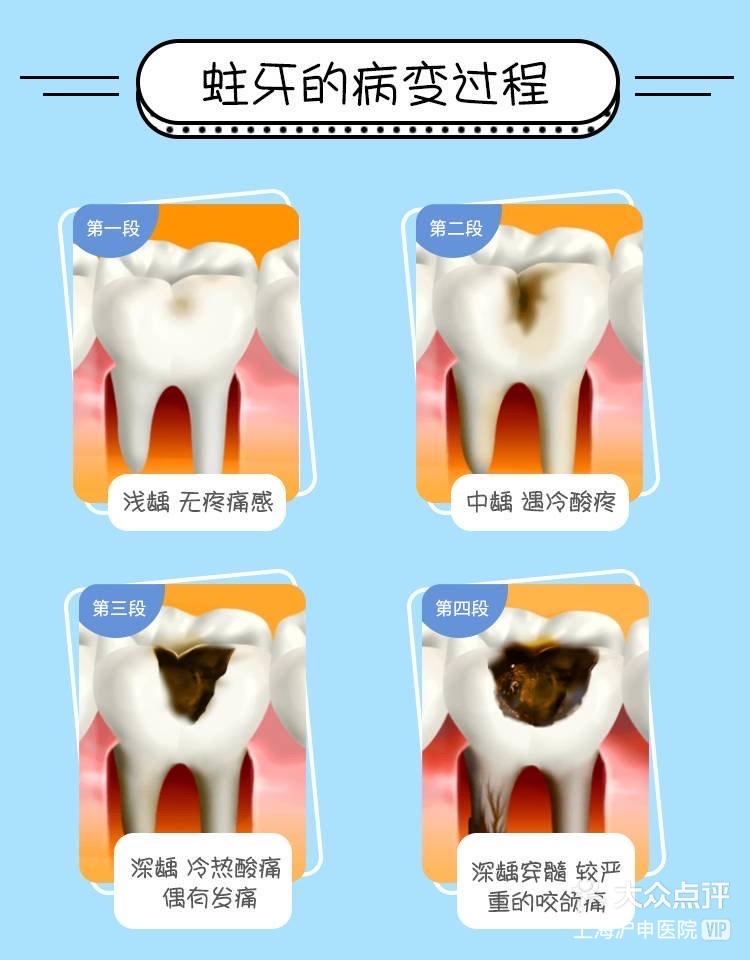 "蛀牙的发展历程"你一定要知道～-大众点评