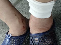 -天津市第三中心医院