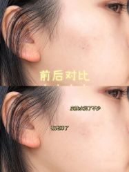 -上海漾颜医疗美容