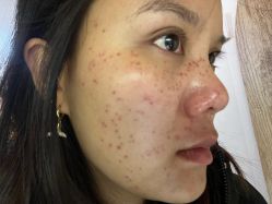 体验后-云南吴氏嘉美医疗美容医院