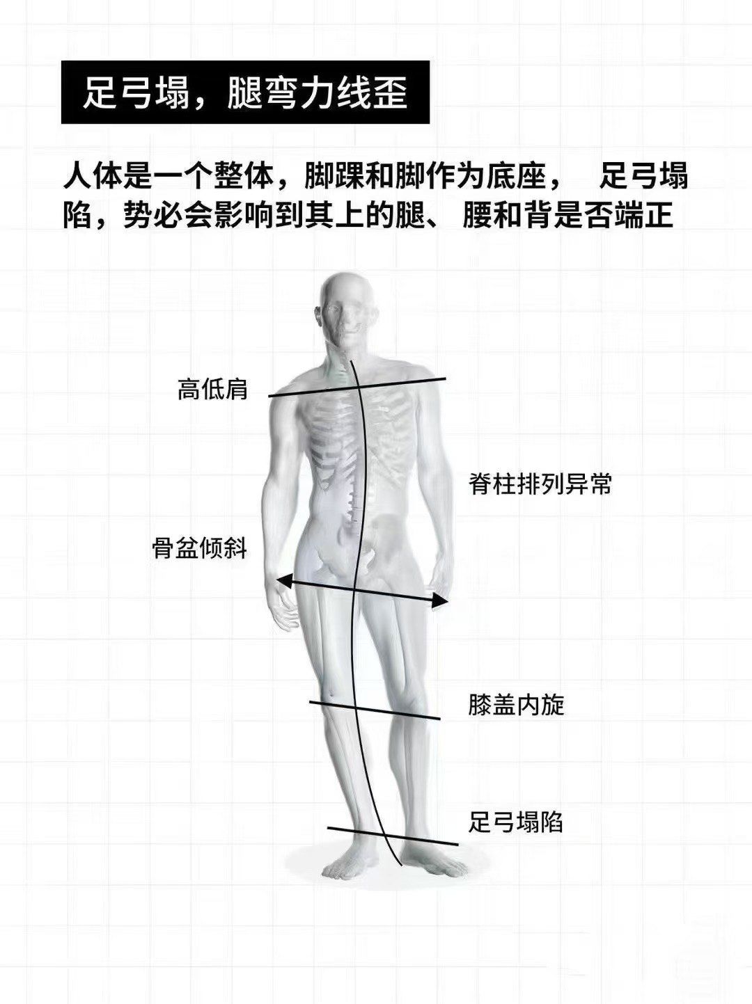 第一步一定是先练下肢力线#体态矫正教程