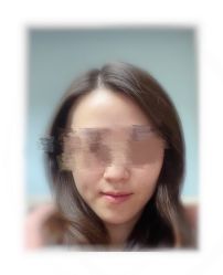 体验后-深圳春天阳光医院·轮廓抗衰中心