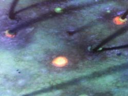 -雍禾植发全国连锁