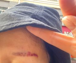 -郡艺医疗美容·微整·眼鼻吸脂