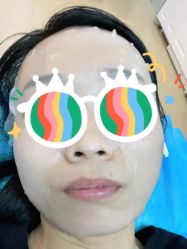 体验后-安徽合肥韩美整形外科医院