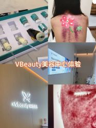 -苑苑vbeauty科技美容SPA
