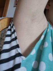 -晶奕空间专业脱毛连锁机构