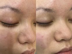 -Cream88颜皮肤管理中心