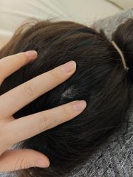 -清疣美疣·痣·斑净肤中心