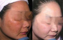 -Cream88颜皮肤管理中心