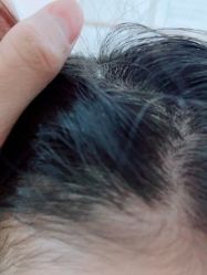 -熙朵美学植发·连锁品牌