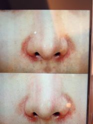 -苑苑vbeauty科技美容SPA