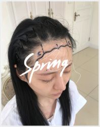 -大麦微针植发全国连锁