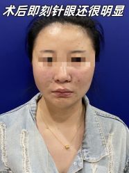 -素美医疗美容·西南眼鼻整形·修复基地