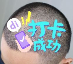 -大麦微针植发全国连锁