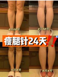 -Yestar宁波艺星整形医院
