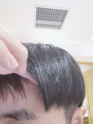 点击看大图 -熙朵美学植发连锁