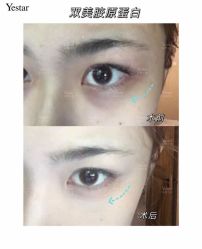 -Yestar艺星医疗美容医院