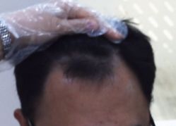 -雍禾植发全国连锁