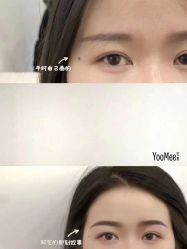 -YooMee优美智能科技美肤机构