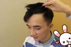 -大麦微针植发丨全国连锁