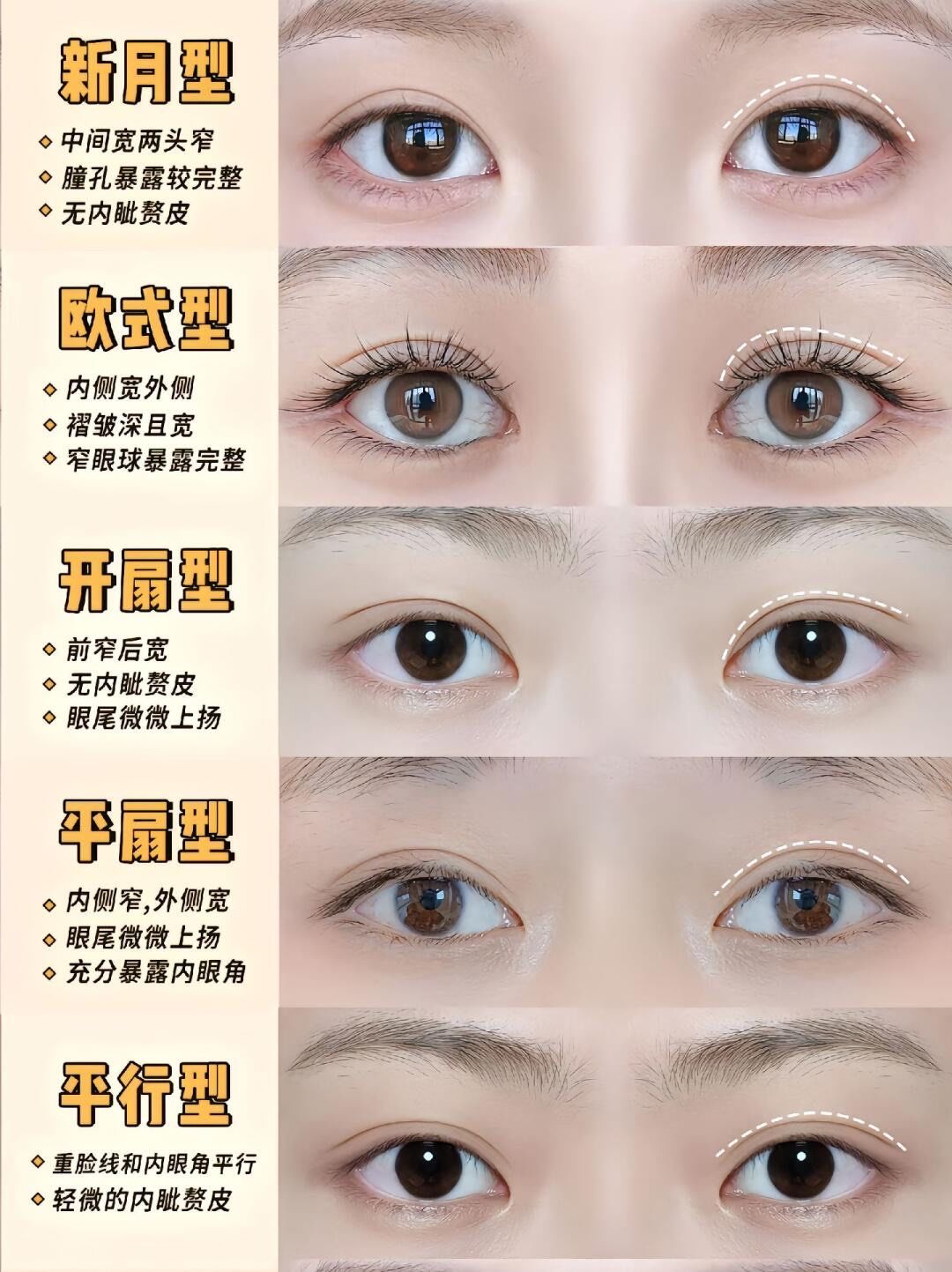 五种双眼皮形态,你觉得哪种好看?