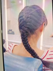 体验后-大麦微针植发全国连锁