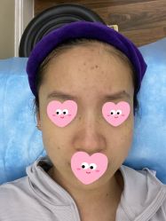 体验后-美莱医疗美容医院