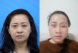 -加减美医美连锁品牌