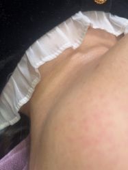 -素美医疗美容·西南眼鼻整形·修复基地