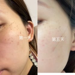 体验后-南昌臻爱医疗美容