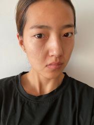 -成都军建医院·疤痕诊疗中心