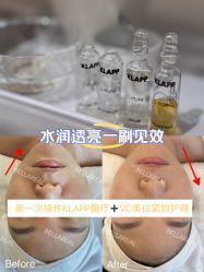 -BELLAREAL新美社