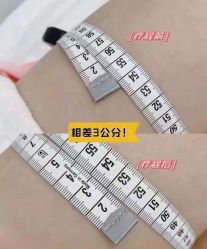 -Lily纤美·科技减脂中心