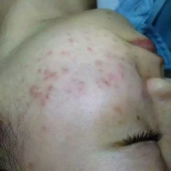 -金品苗方专业祛痘中心