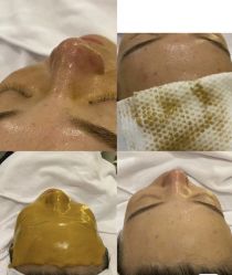 -SKIN79皮肤管理中心