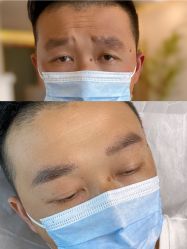 -Doris多里斯半永久纹眉·SMP纹发·发际线